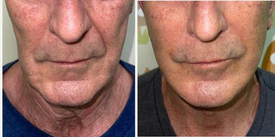 Roberto™ Device & Conductive Gel