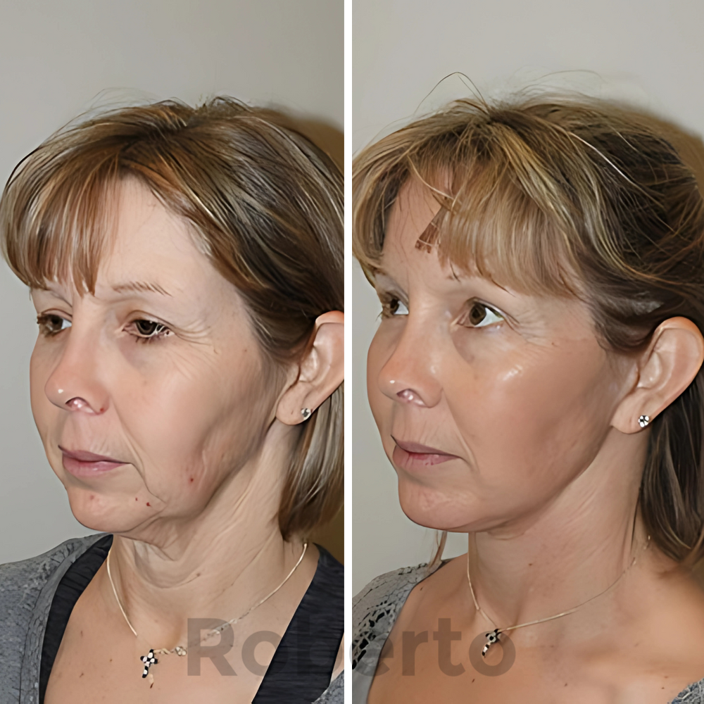 Real Customers Real Results Angela Brooks 69 Turkey Neck