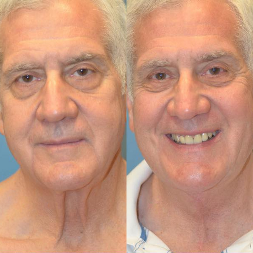 Roberto™ Device & Conductive Gel